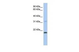 Anti-CLECL1 antibody, Internal used in Western Blot (WB). GTX45589