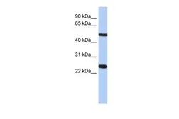 Anti-TMEM161B antibody, N-term used in Western Blot (WB). GTX45604