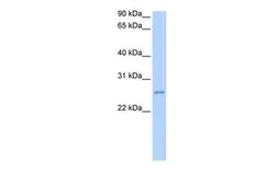 Anti-RPESP antibody, C-term used in Western Blot (WB). GTX45616