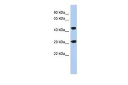 Anti-C22ORF25 antibody, N-term used in Western Blot (WB). GTX45623