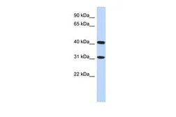 Anti-FAM46D antibody, Internal used in Western Blot (WB). GTX45632