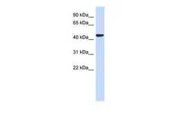 Anti-SGMS2 antibody, N-term used in Western Blot (WB). GTX45633