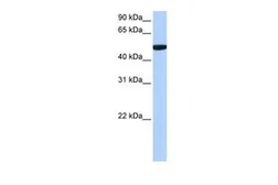 Anti-C1ORF55 antibody, C-term used in Western Blot (WB). GTX45636