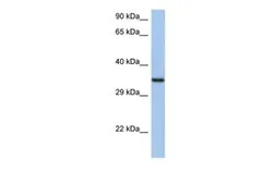 Anti-HORMAD2 antibody, N-term used in Western Blot (WB). GTX45650