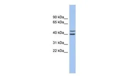 Anti-FBXL14 antibody, N-term used in Western Blot (WB). GTX45657