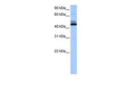 Anti-C15ORF27 antibody, Internal used in Western Blot (WB). GTX45676