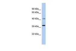 Anti-C11ORF46 antibody, N-term used in Western Blot (WB). GTX45679