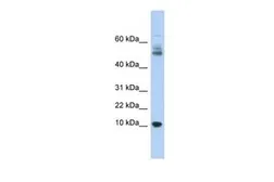 Anti-MTPN antibody, Internal used in Western Blot (WB). GTX45682