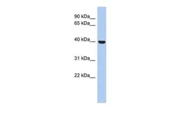 Anti-STOML3 antibody, N-term used in Western Blot (WB). GTX45686