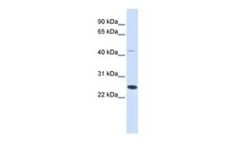 Anti-FAM119A antibody, Internal used in Western Blot (WB). GTX45687