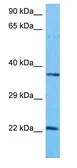 Anti-DDIT4L antibody, Internal used in Western Blot (WB). GTX45694