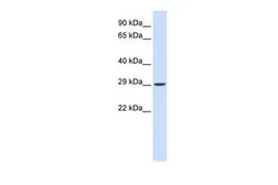 Anti-VTI1A antibody, N-term used in Western Blot (WB). GTX45696