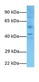 Anti-ARL13B antibody, Internal used in Western Blot (WB). GTX45702