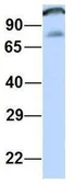 Anti-CCDC52 antibody, Internal used in Western Blot (WB). GTX45708