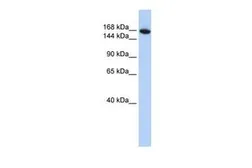 Anti-WDR66 antibody, N-term used in Western Blot (WB). GTX45713