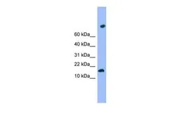 Anti-TMEM42 antibody, N-term used in Western Blot (WB). GTX45718