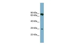 Anti-CYB5D1 antibody, Internal used in Western Blot (WB). GTX45722