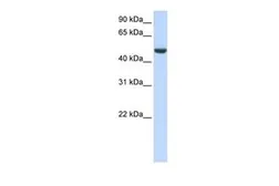 Anti-SPATA17 antibody, C-term used in Western Blot (WB). GTX45735