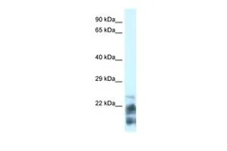 Anti-MDP1 antibody, N-term used in Western Blot (WB). GTX45739