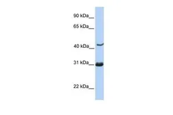 Anti-Nup53 antibody, C-term used in Western Blot (WB). GTX45750