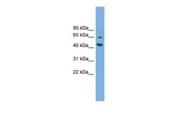 Anti-WIPF2 antibody, Internal used in Western Blot (WB). GTX45756