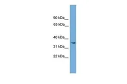 Anti-ASB17 antibody, Internal used in Western Blot (WB). GTX45761