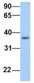 Anti-ERI2 antibody, Internal used in Western Blot (WB). GTX45767
