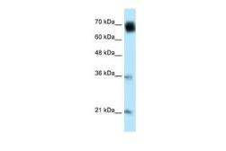 Anti-GLMN antibody, C-term used in Western Blot (WB). GTX45771