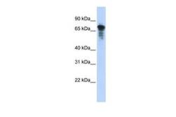 Anti-RHPN1 antibody, Internal used in Western Blot (WB). GTX45779