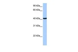 Anti-CC2D1B antibody, C-term used in Western Blot (WB). GTX45782