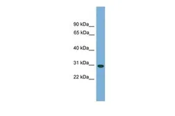 Anti-CA5B antibody, N-term used in Western Blot (WB). GTX45795