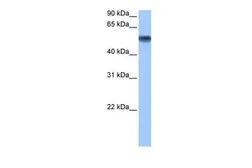 Anti-METAP2 antibody, N-term used in Western Blot (WB). GTX45796