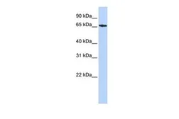 Anti-SDCCAG8 antibody, Internal used in Western Blot (WB). GTX45798