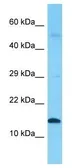 Anti-INSL5 antibody, Internal used in Western Blot (WB). GTX45807
