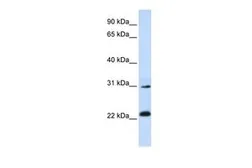 Anti-AP3S1 antibody, N-term used in Western Blot (WB). GTX45817