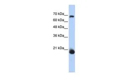 Anti-CHCHD4 antibody, N-term used in Western Blot (WB). GTX45825