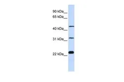 Anti-FAM153B antibody, Internal used in Western Blot (WB). GTX45831