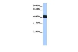 Anti-LRRC17 antibody, Internal used in Western Blot (WB). GTX45836