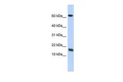 Anti-C4orf46 antibody, Internal used in Western Blot (WB). GTX45841