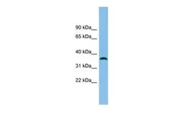 Anti-C18orf25 antibody, N-term used in Western Blot (WB). GTX45843