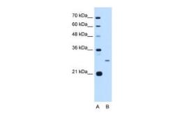 Anti-ASPH antibody, N-term used in Western Blot (WB). GTX45856