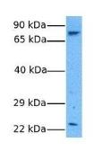 Anti-ASPH antibody, N-term used in Western Blot (WB). GTX45857