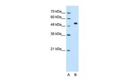 Anti-CCDC19 antibody, N-term used in Western Blot (WB). GTX45859