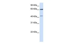 Anti-CCDC19 antibody, N-term used in Western Blot (WB). GTX45860