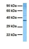 Anti-MAS1 antibody, Internal used in Western Blot (WB). GTX45869