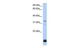 Anti-B3GALT6 antibody, N-term used in Western Blot (WB). GTX45883