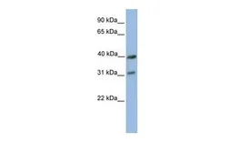 Anti-MTCO3 antibody, C-term used in Western Blot (WB). GTX45887