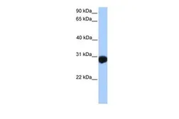 Anti-SLAMF6 antibody, N-term used in Western Blot (WB). GTX45894