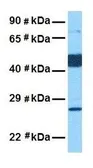 Anti-PIK3IP1 antibody, Internal used in Western Blot (WB). GTX45899