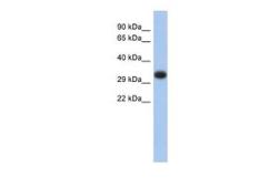 Anti-HLA-DPA1 antibody, Internal used in Western Blot (WB). GTX45903